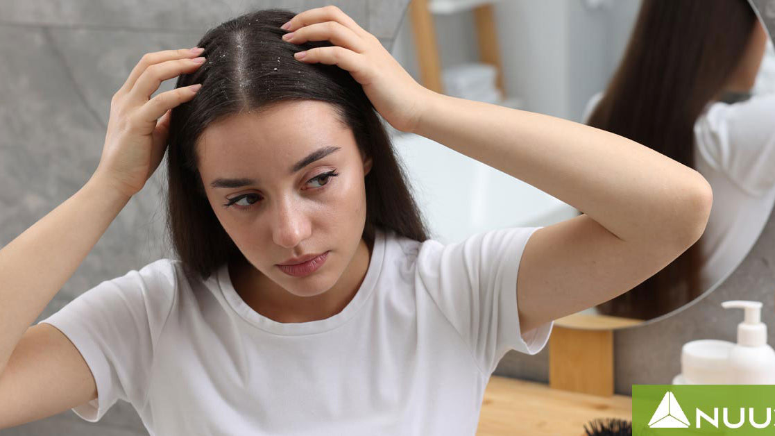 How to Manage Scalp Eczema and Relieve Itchy, Flaky Skin